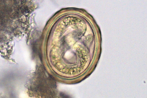 Ascaris lumbricoides – glista ludzka